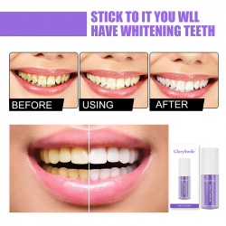 Branqueadores dentais Glory Smile® V34 corretor de cor para branqueamento dentário
