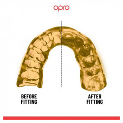 Bite e Dispositivi Opro Instant Fit Gold paradenti tecnologia rivoluzionaria per la protezione dentale negli sport di contatto