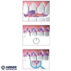 Higiene bucal | Blanqueadores Tabletas de prueba de placa Mira 2 Ton®