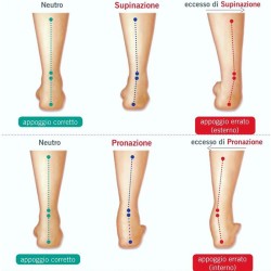 Orthopädie und Podologie Ortoplant Anpassbare orthopädische Einlagen